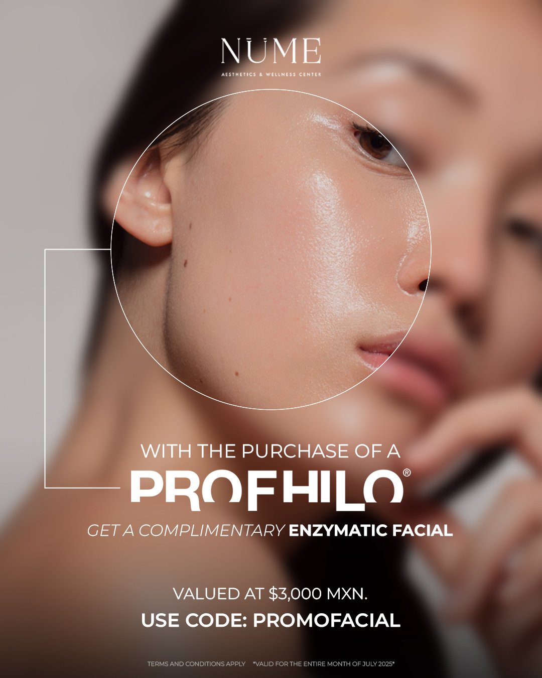 Promotion profhilo