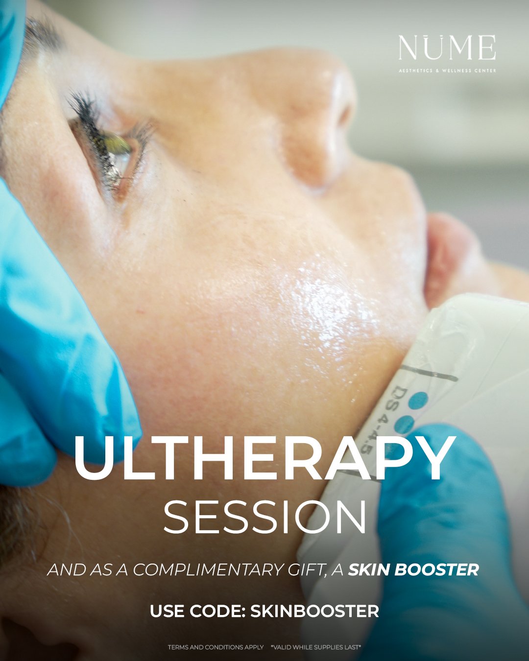 Promotions Ultheraphy®