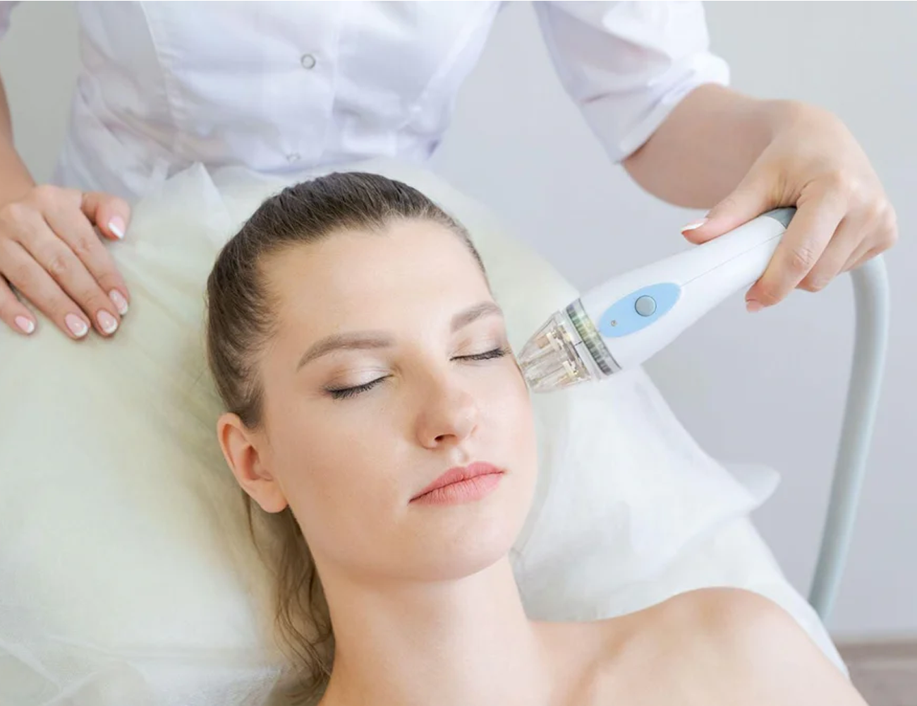 Microneedling with enzymes